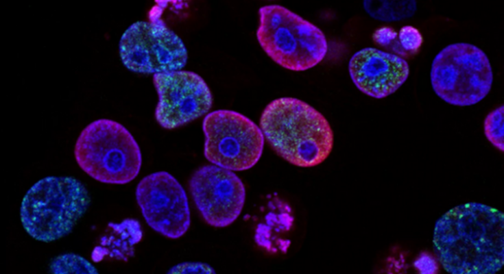 Descubren tipos de cáncer a través de la orina