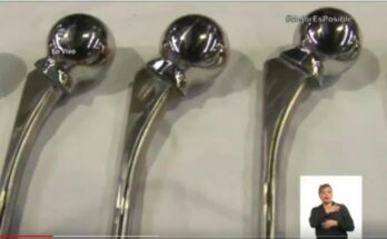 uso de prótesis cubana parcial de cadera