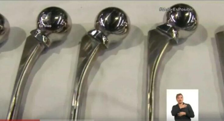 Evalúan uso de prótesis cubana parcial de cadera 1 uso de prótesis cubana parcial de cadera